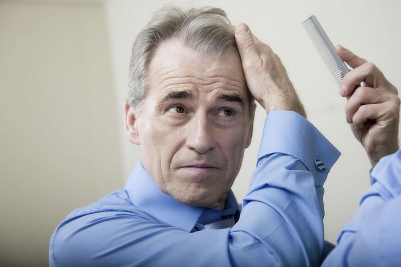 Acute Hair Loss