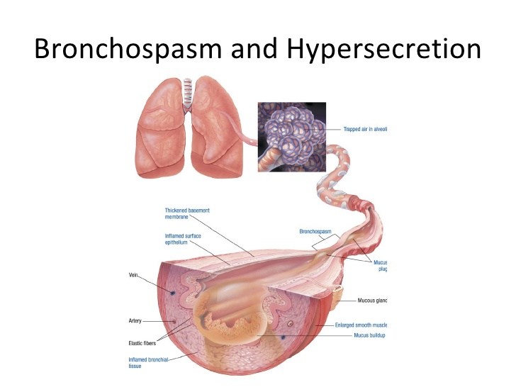 Bronchospasm