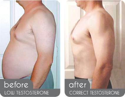 Testosterone Replacement Therapy