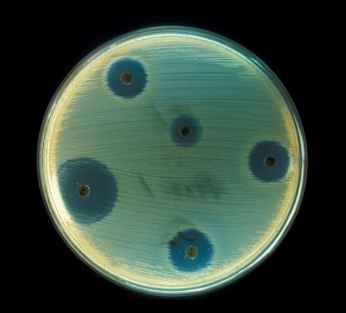 bacteria